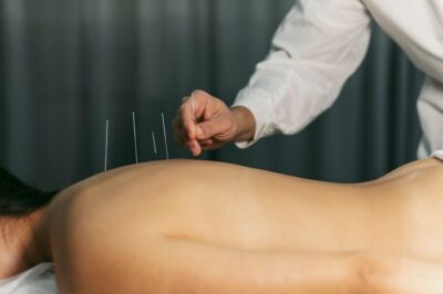 Can Acupuncture Help With Weight Loss?